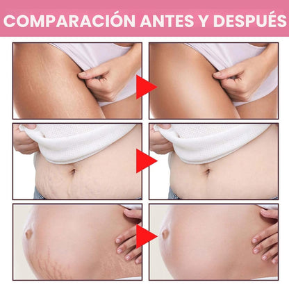Adeus Crema Brasileña para Estrías con Árnica, Jengibre, Cafeína y Té Verde 300g