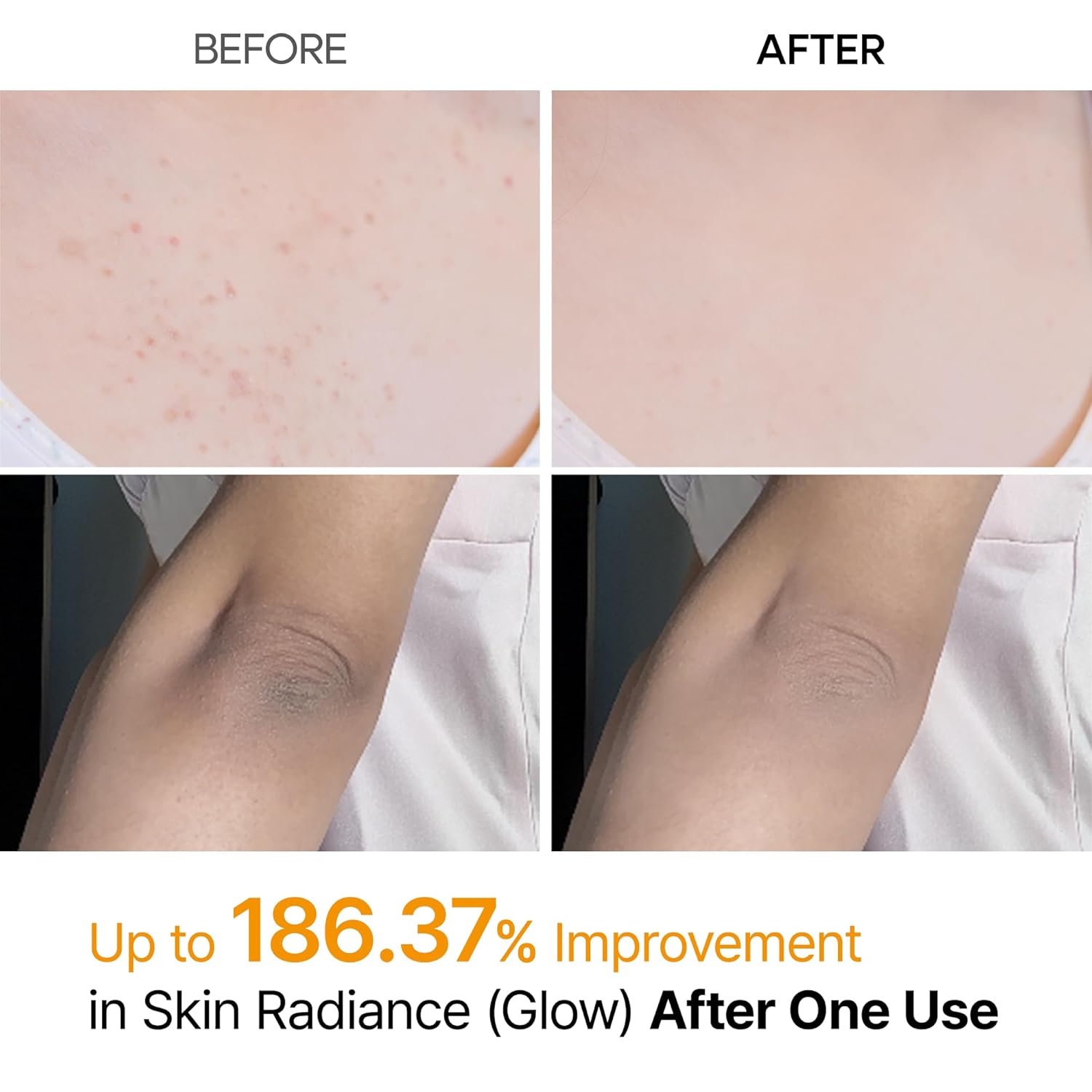 Dr.Melaxin Spray Exfoliante Corporal Ácido Kójico y Cúrcuma 200ml