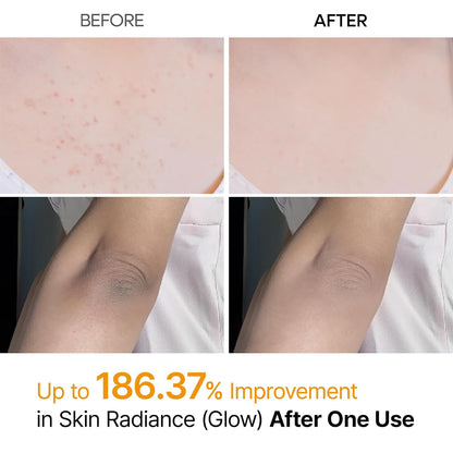 Dr.Melaxin Spray Exfoliante Corporal Ácido Kójico y Cúrcuma 200ml